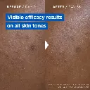 5-MixaNiacinamideBright-Jar3600551164441_4df04b20-0fc9-4971-9056-9d065e6a6c7a.webp