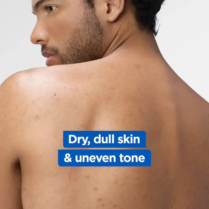 3-MixaNiacinamideBright-Lotion3600551164519.webp